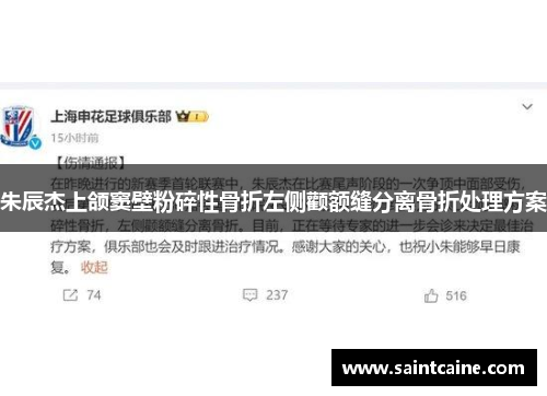 朱辰杰上颌窦壁粉碎性骨折左侧颧额缝分离骨折处理方案
